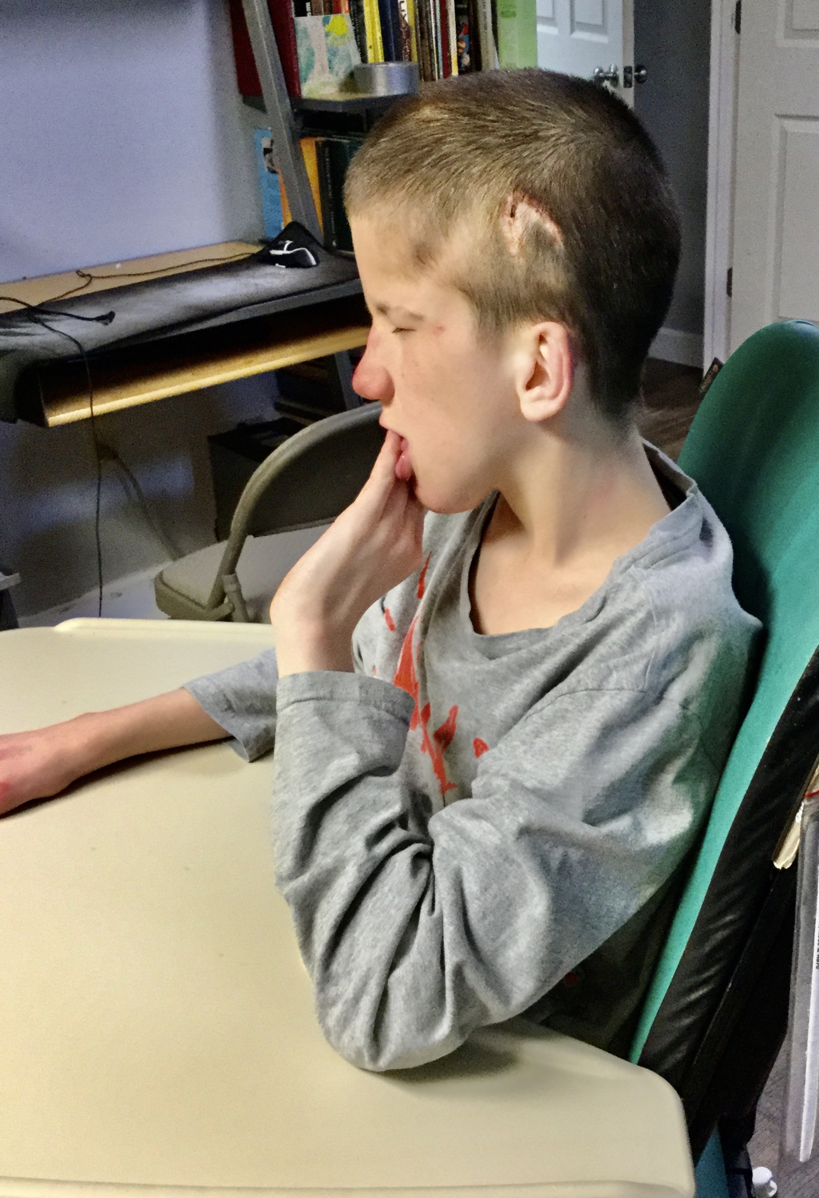 Luke Update – Caring for Special Needs After ICU